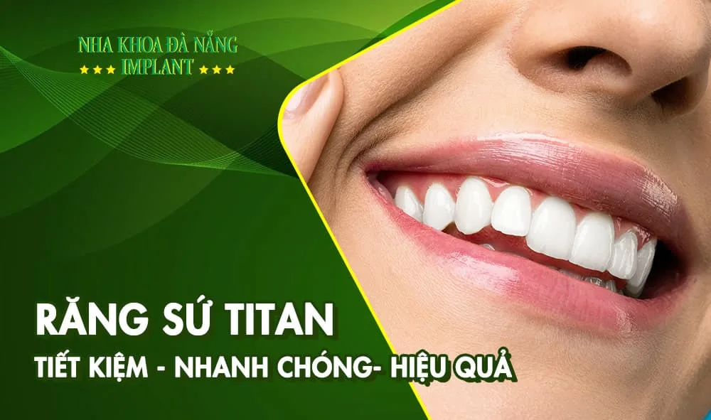 Trồng răng sứ titan giá rẻ giải pháp phục hình răng bền vững