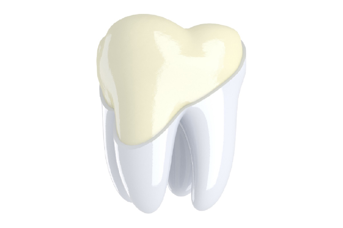 Dấu hiệu nhận biết mòn men răng sớm ngăn ngừa ê buốt răng