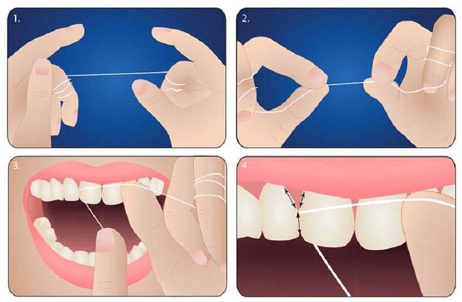 Hướng dẫn cách sử dụng chỉ nha khoa sạch sâu từng kẽ răng