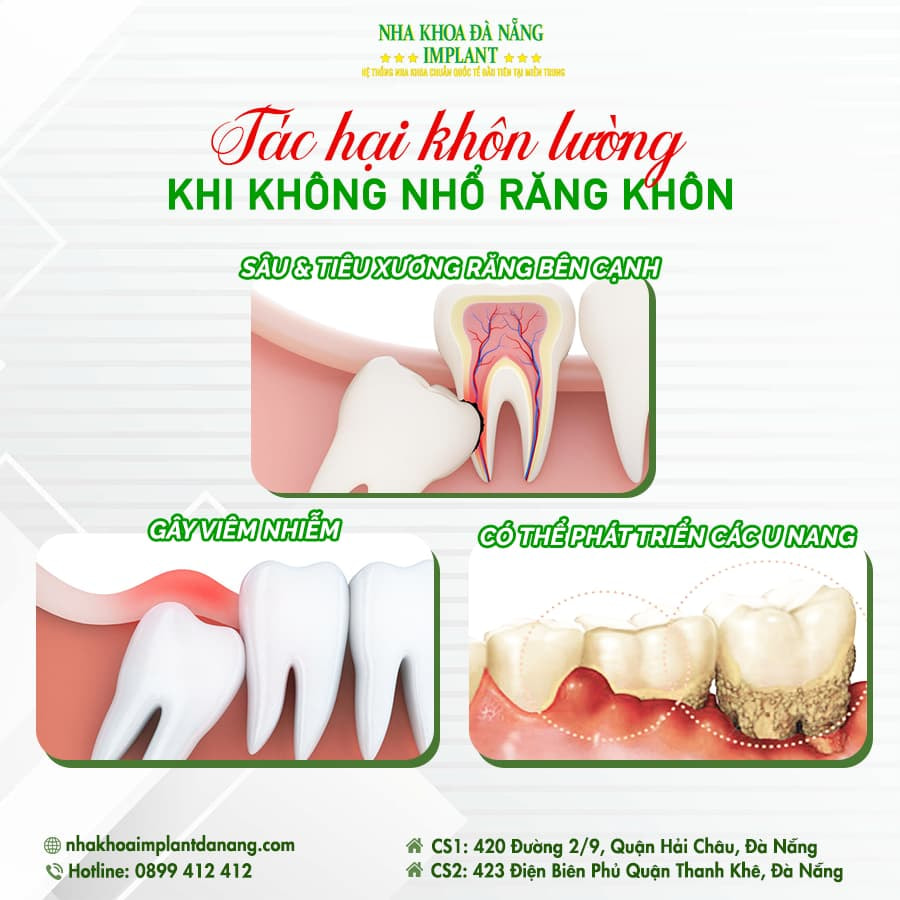 Xét nghiệm máu trước khi nhổ răng khôn là cần thiết để đảm bảo an toàn cho bệnh nhân. Xét nghiệm máu giúp bác sĩ xác định tình trạng sức khỏe tổng quát của bệnh nhân