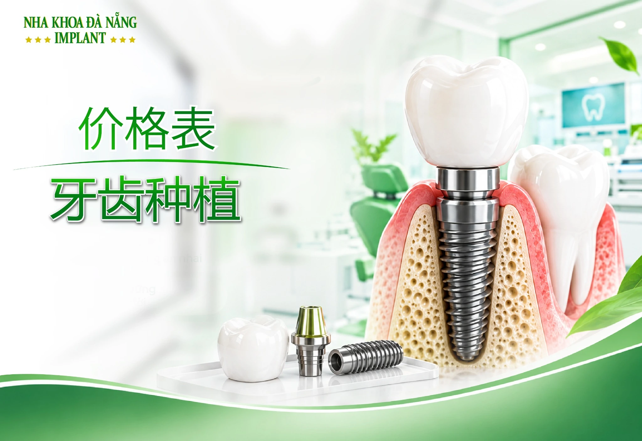 种植牙价目表