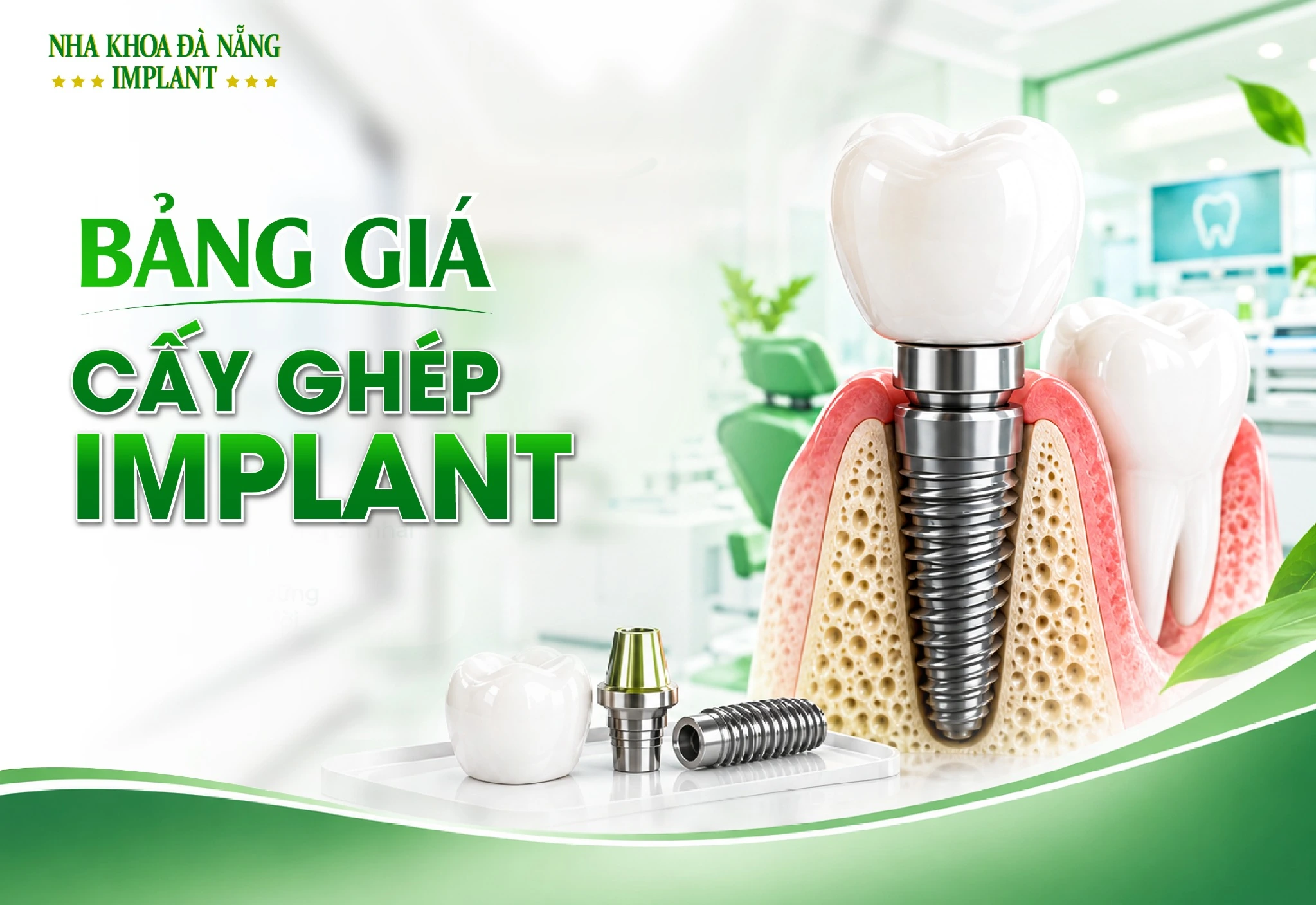 Bảng giá điều trị Implant