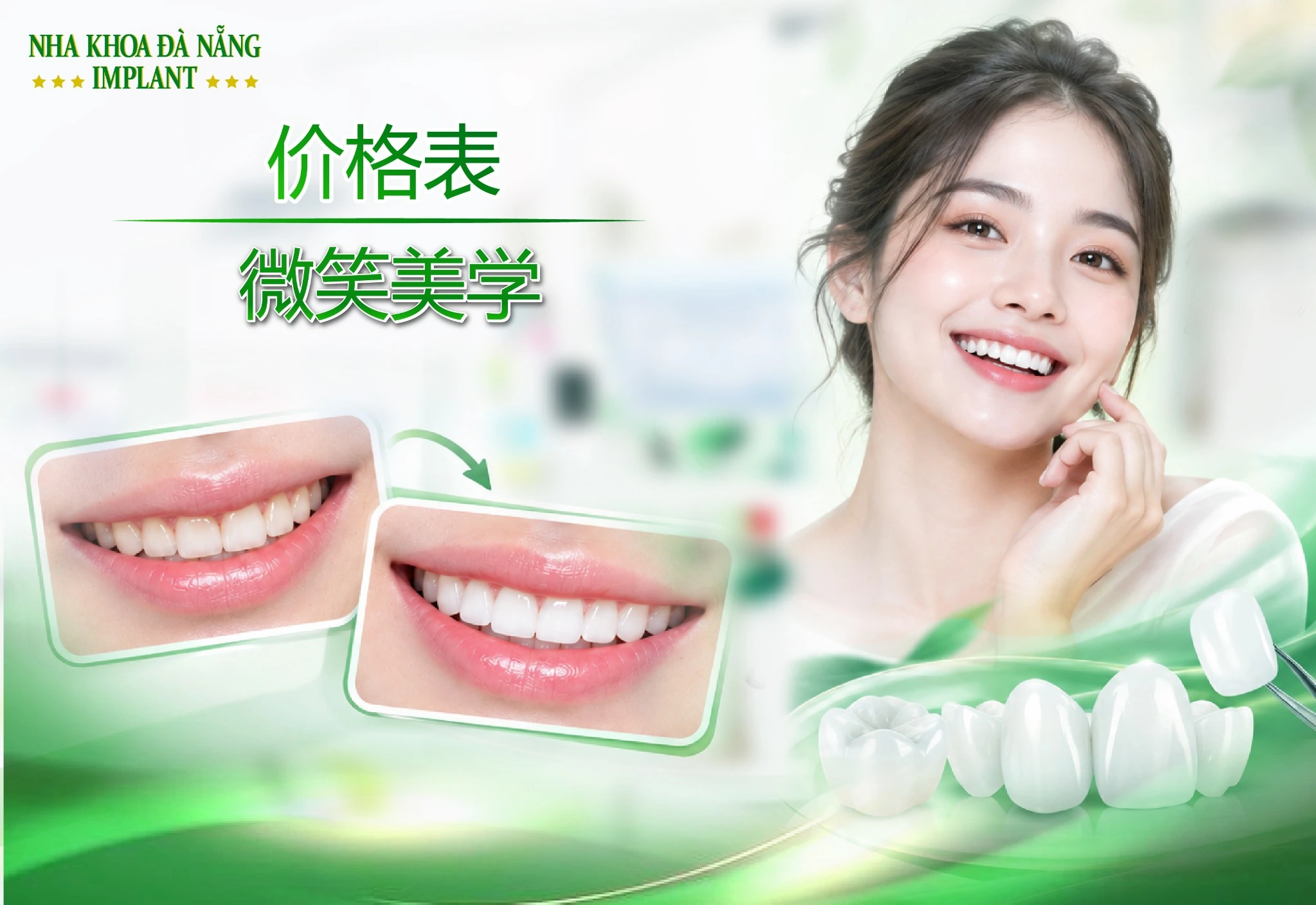 微笑美学治疗价目表