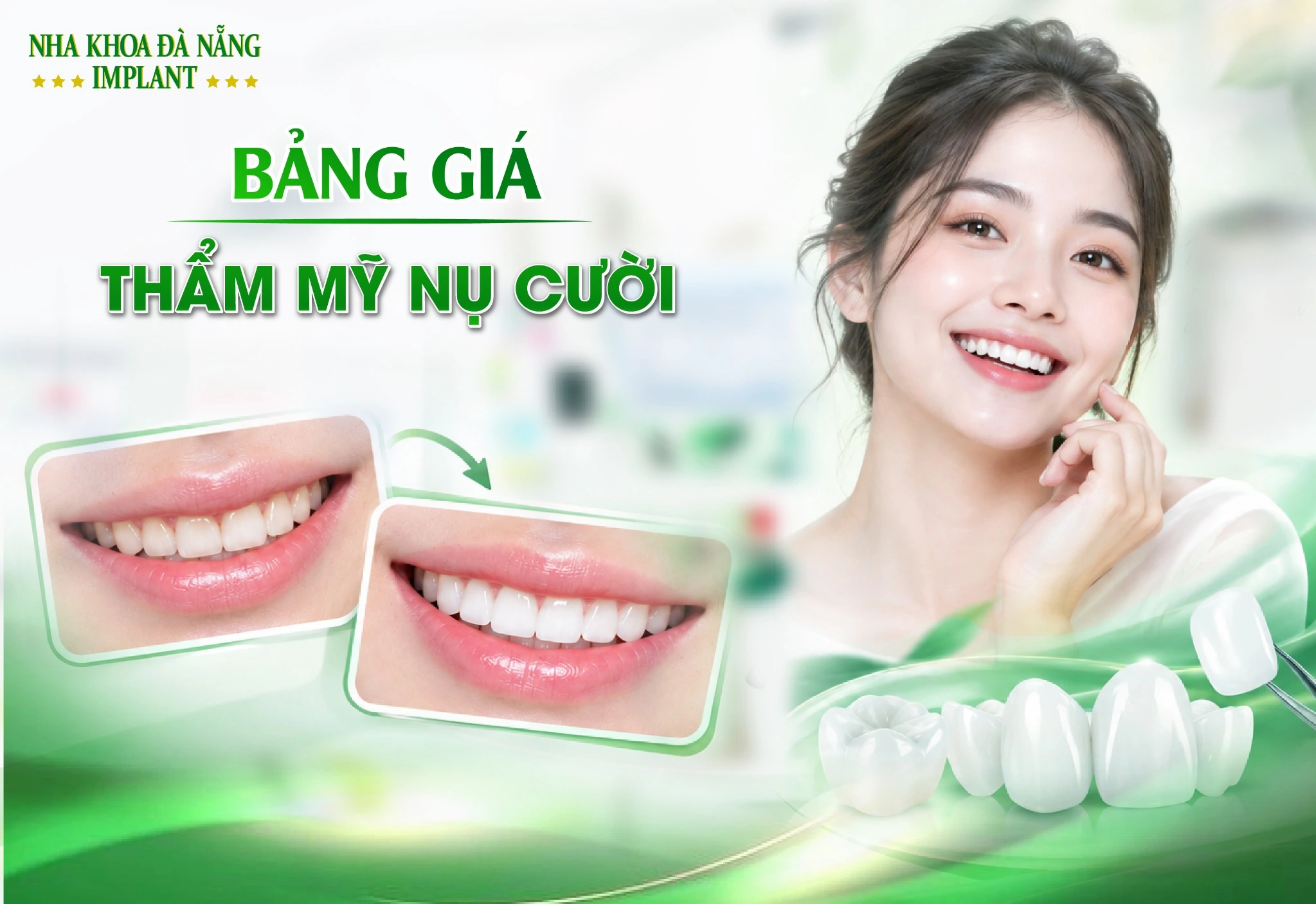 Bảng giá dịch vụ Thẩm mỹ Nụ cười