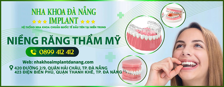 Cosmetic braces at Da Nang Implant Dental Clinic