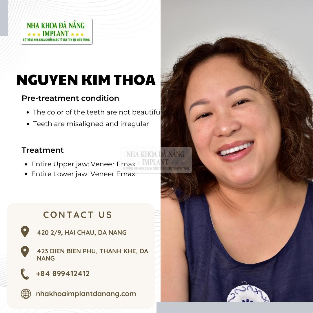 Customer: Nguyen Kim Thoa - Treatment: Porcelain Veneers