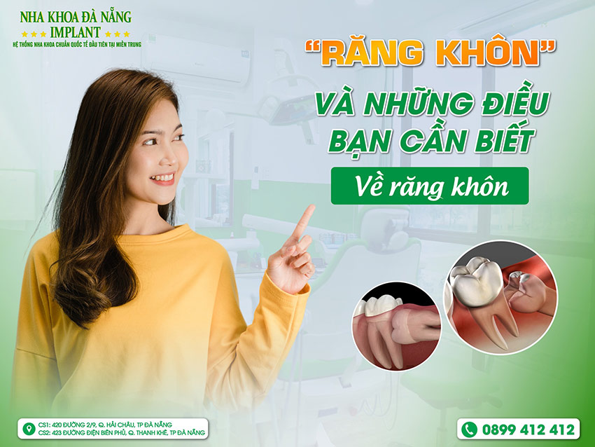 Răng khôn là gì? Nhổ răng khôn có đau không?