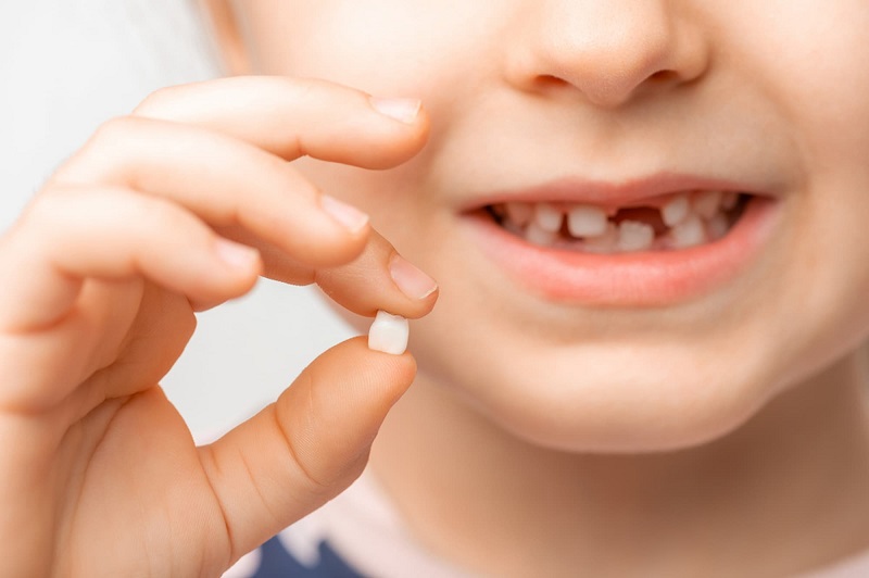 Cách xử lý khi răng sữa của trẻ bị mòn mà cha mẹ cần biết