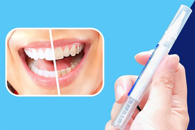 Vì sao tẩy răng trắng không đều? Tẩy trắng răng nhiều lần có sao không?