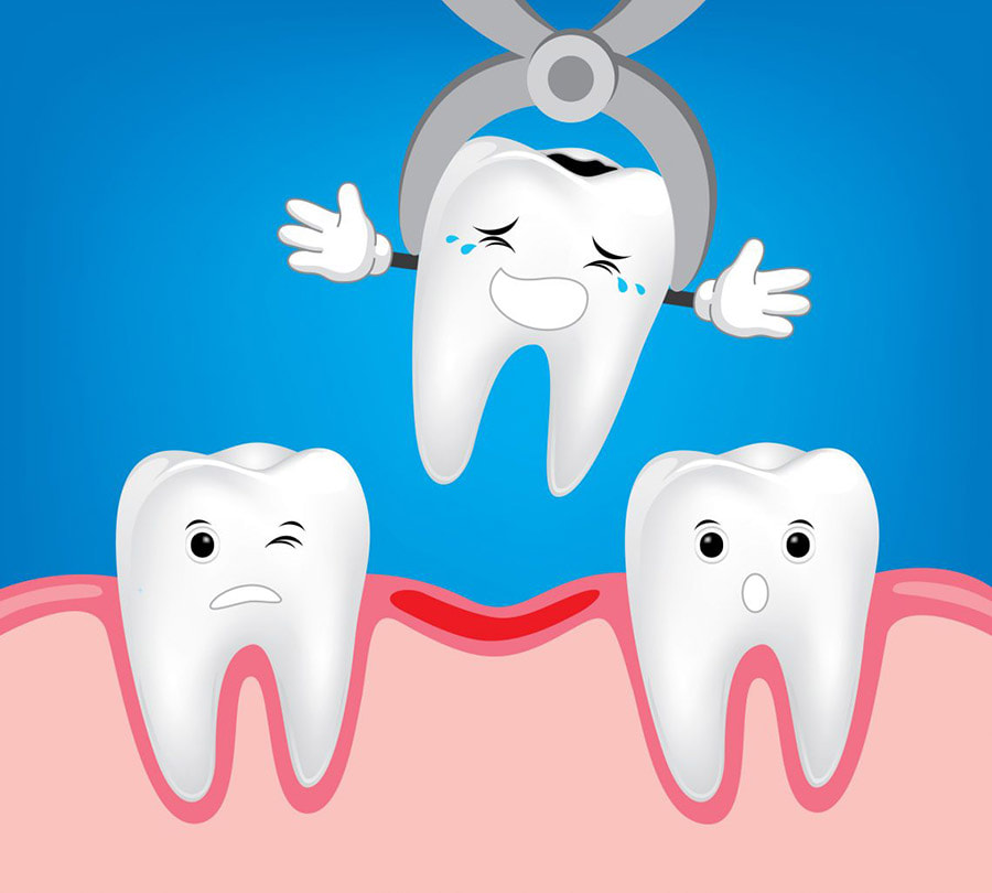 Răng khôn khi trong quá trình mọc sẽ bị mắc kẹt ở phần lợi răng khiến lợi của bạn bị đau nhức