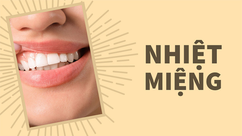 Nhiệt miệng không gây nguy hiểm, có thể tự lành sau khoảng 1 tuần, tối đa 10 ngày mà không cần can thiệp điều trị