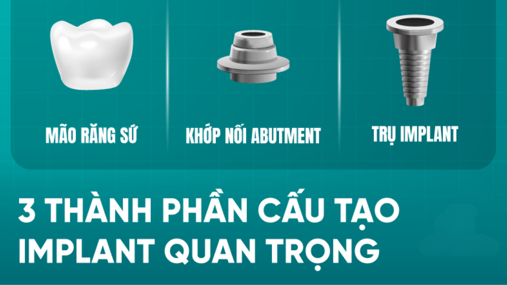 3 thành phần cấu tạo Implant