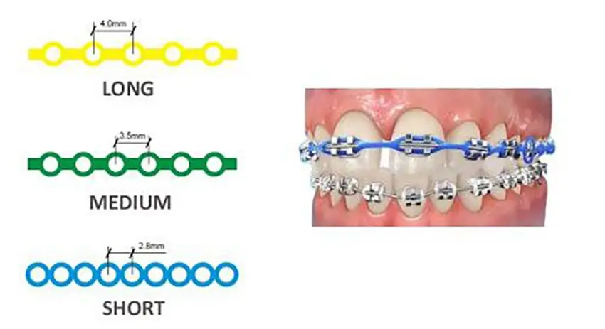 Các loại thun chuỗi trong chỉnh nha