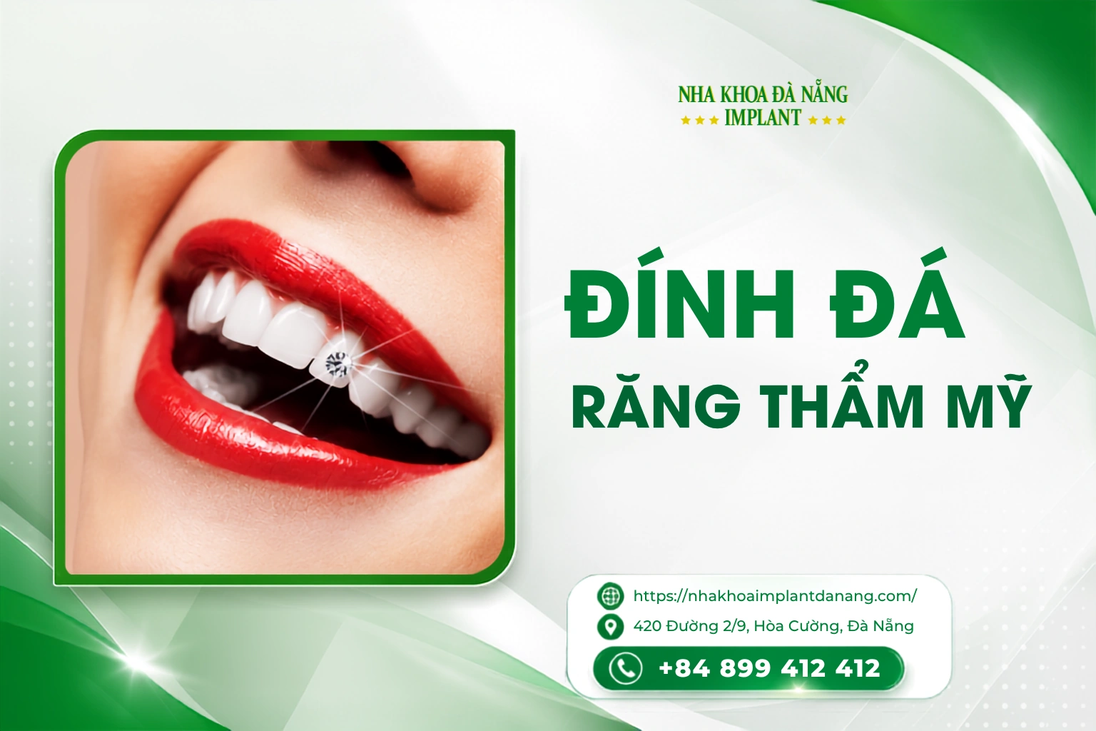 Đính đá vào răng thẩm mỹ
