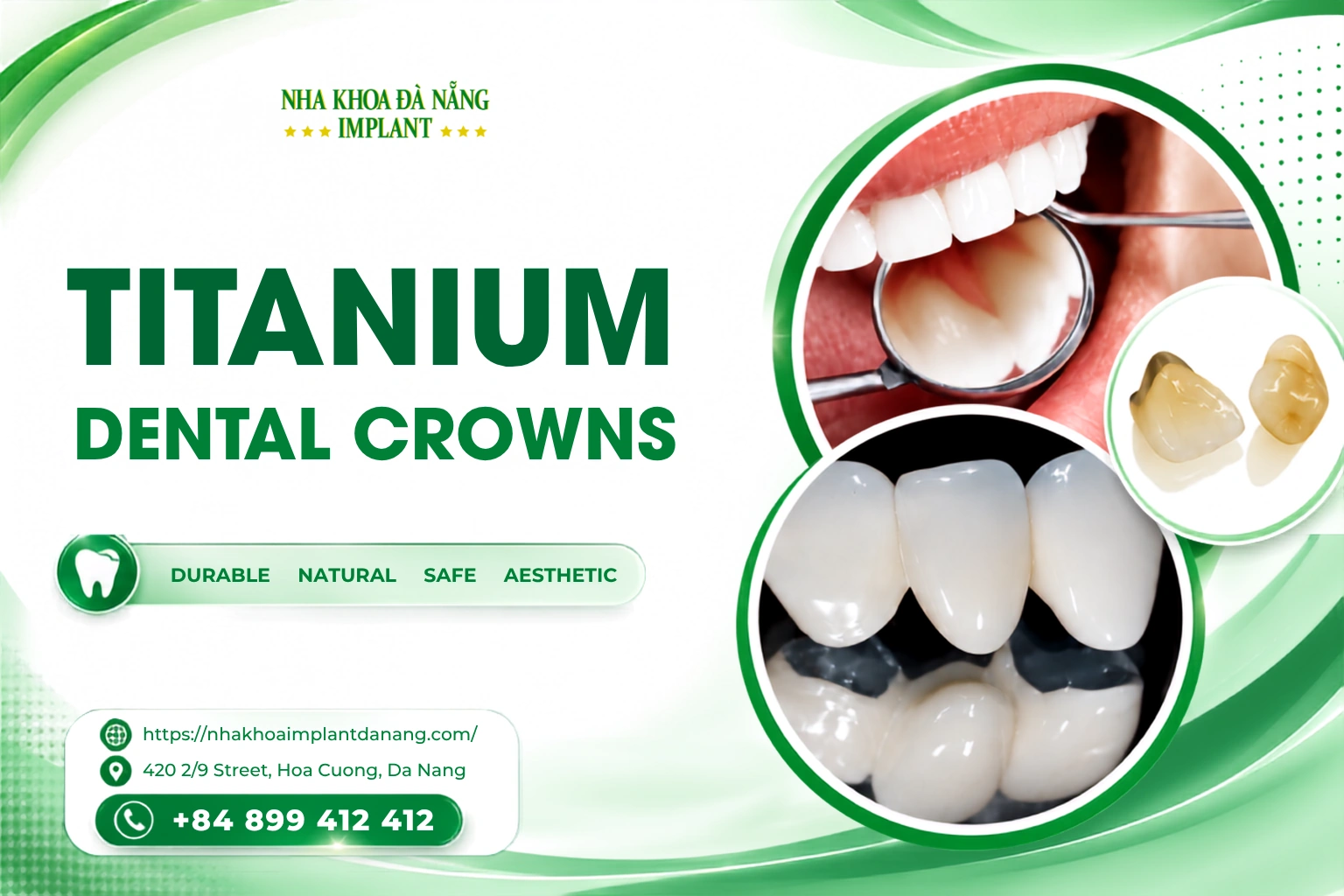 Titanium Porcelain Crowns