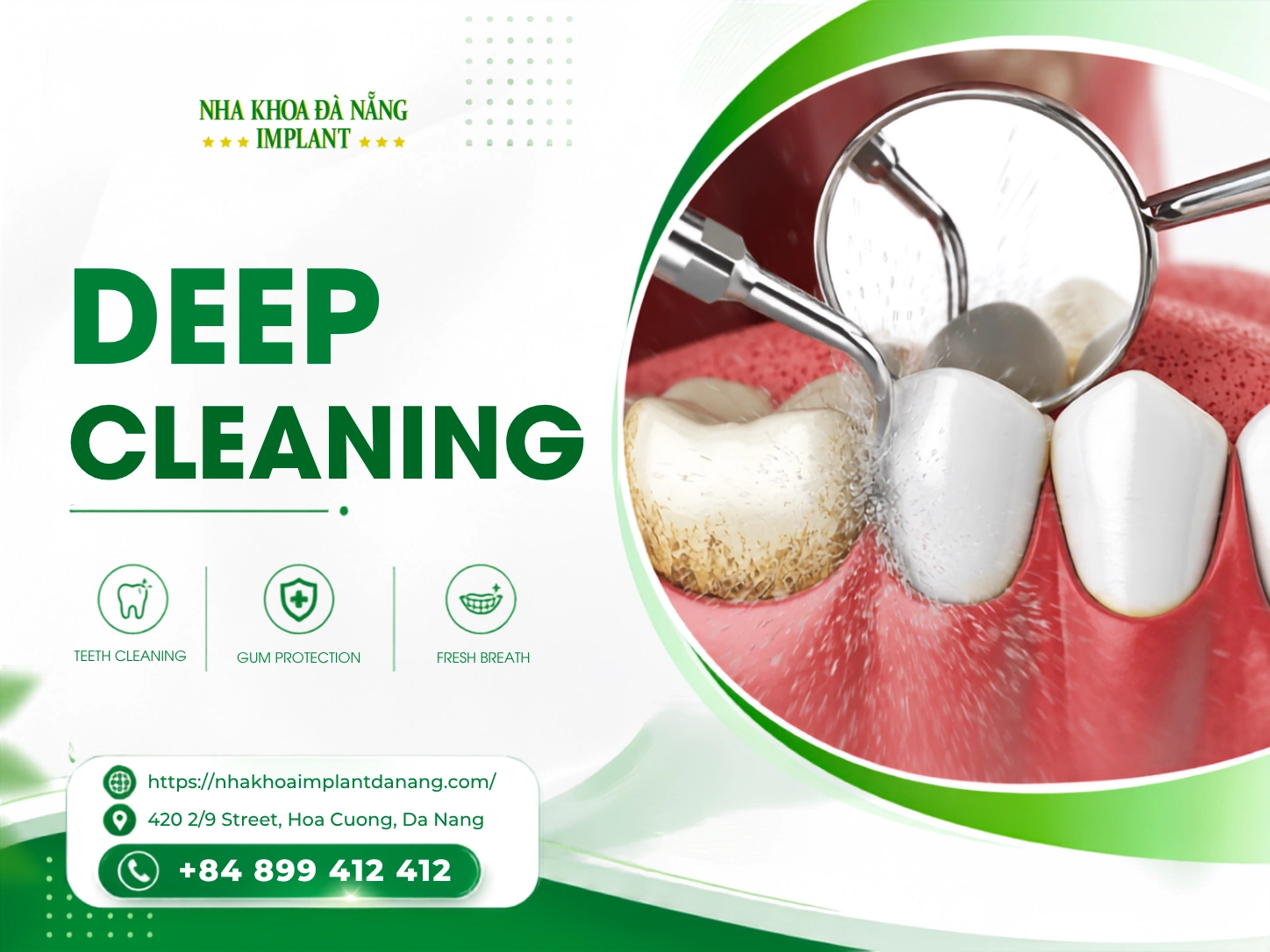 Deep clean