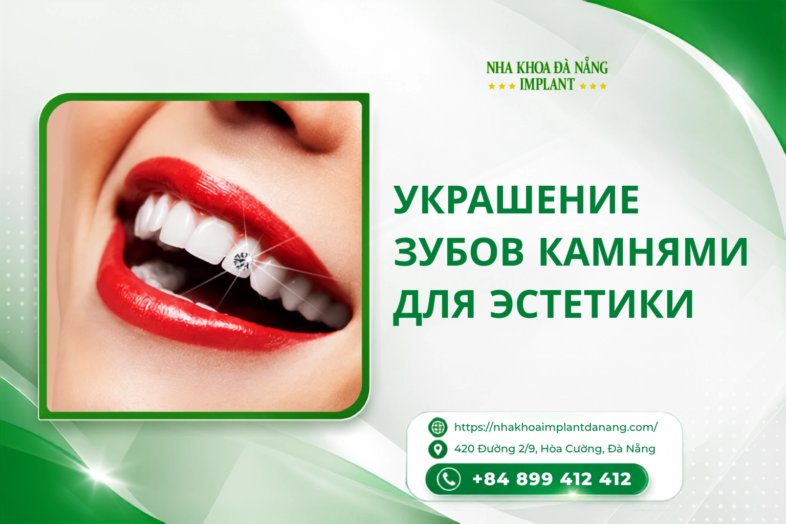 Украшение зубов камнями для эстетики