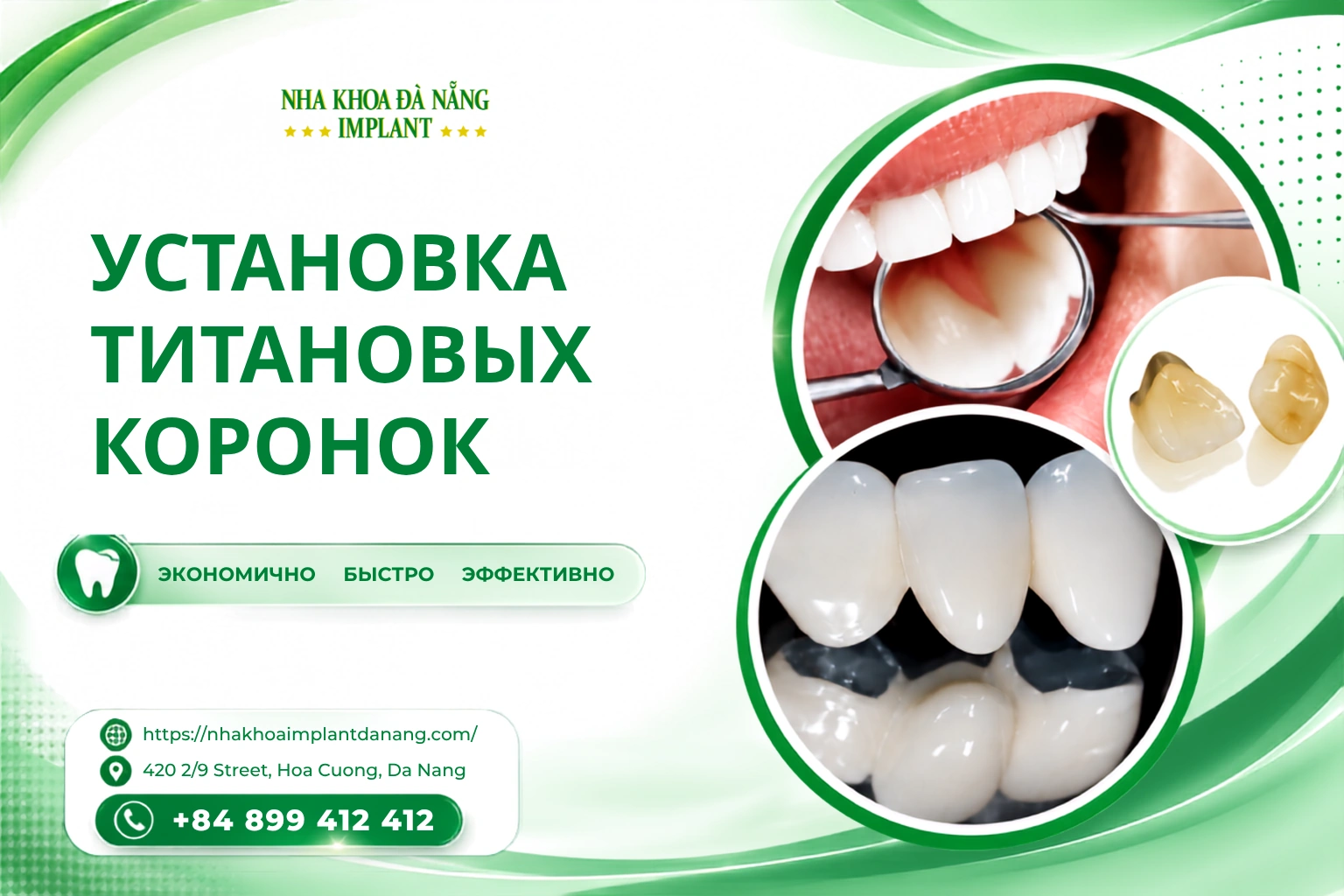 Установка титановых коронок – Экономично, Быстро, Эффективно