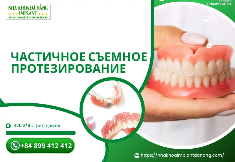 Частичное съемное протезирование