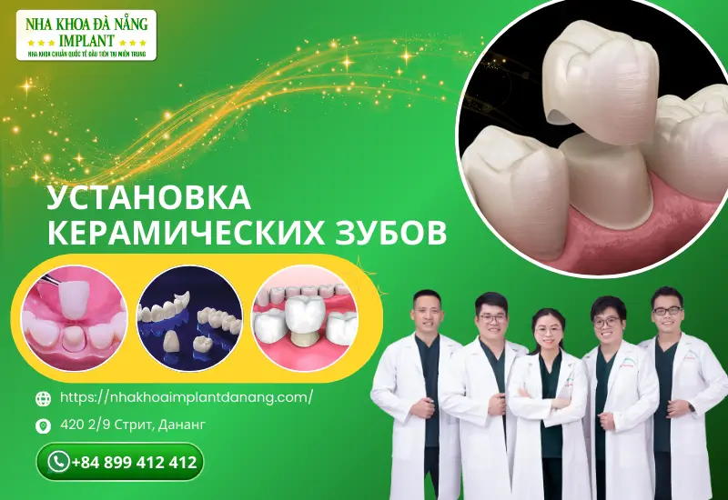 Установка керамических зубов
