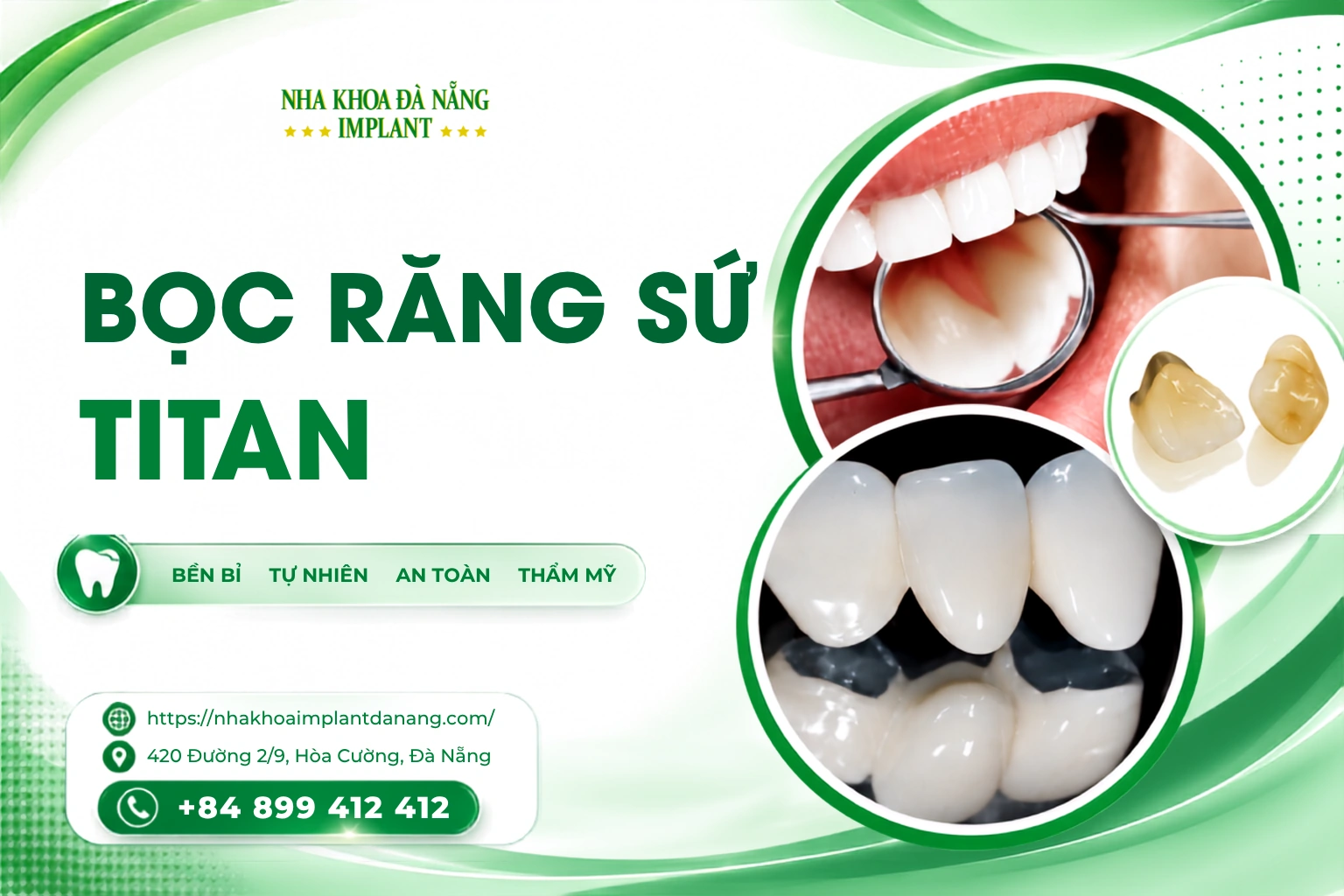 Bọc răng sứ Titan - Tiết kiệm, Nhanh chóng, Hiệu quả