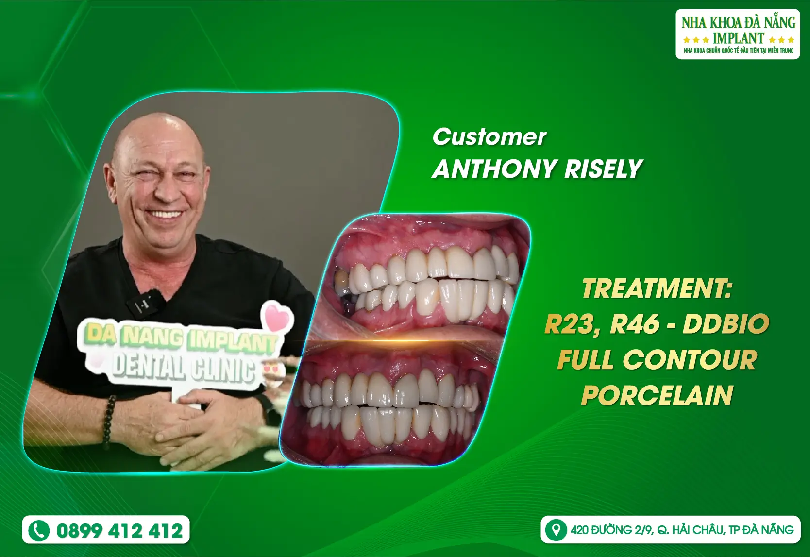 [FEEDBACK] Customer care service is one of the advantages of Danang Implant Dental Clinic