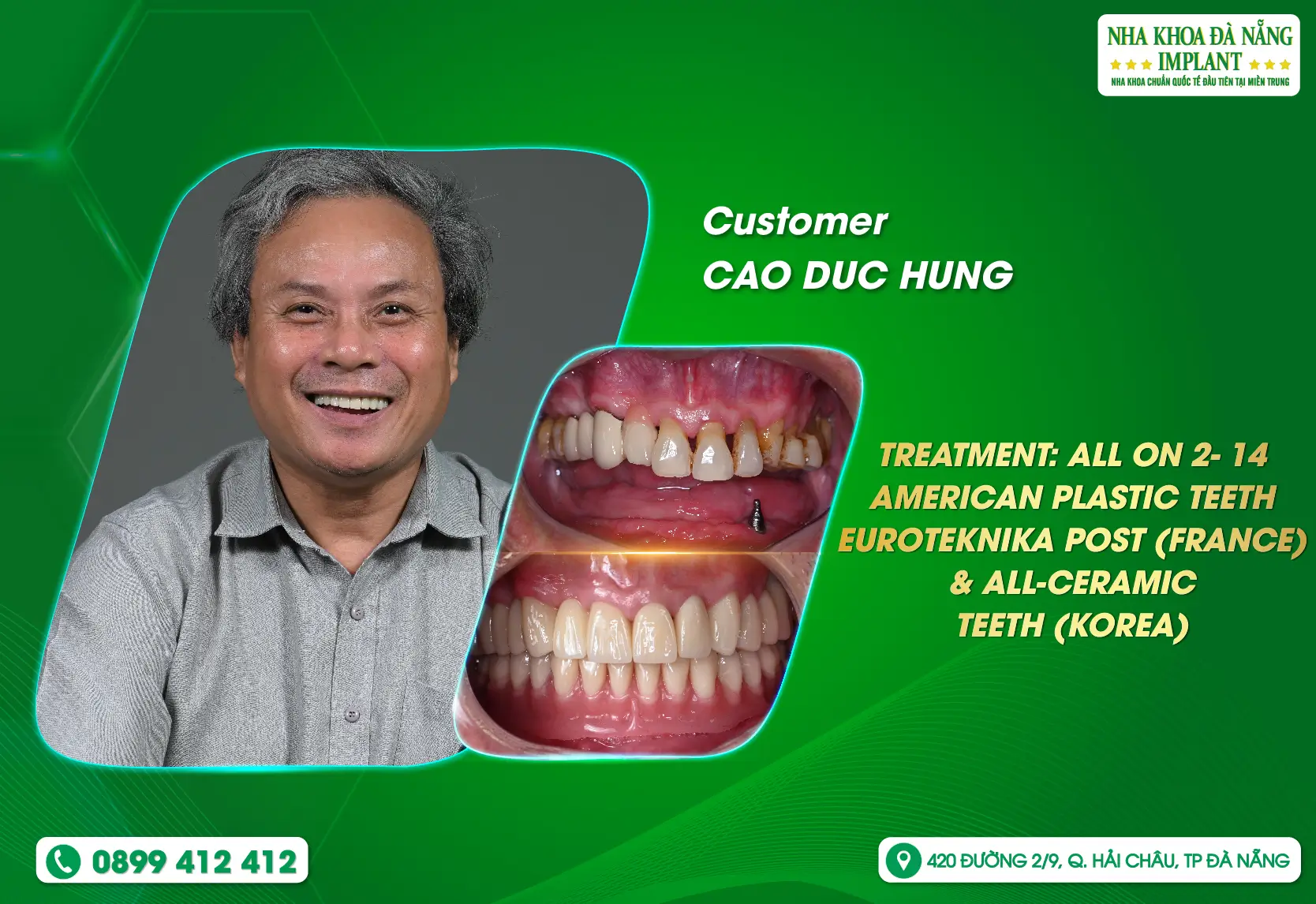 Find your smile again - Eating and chewing is convenient