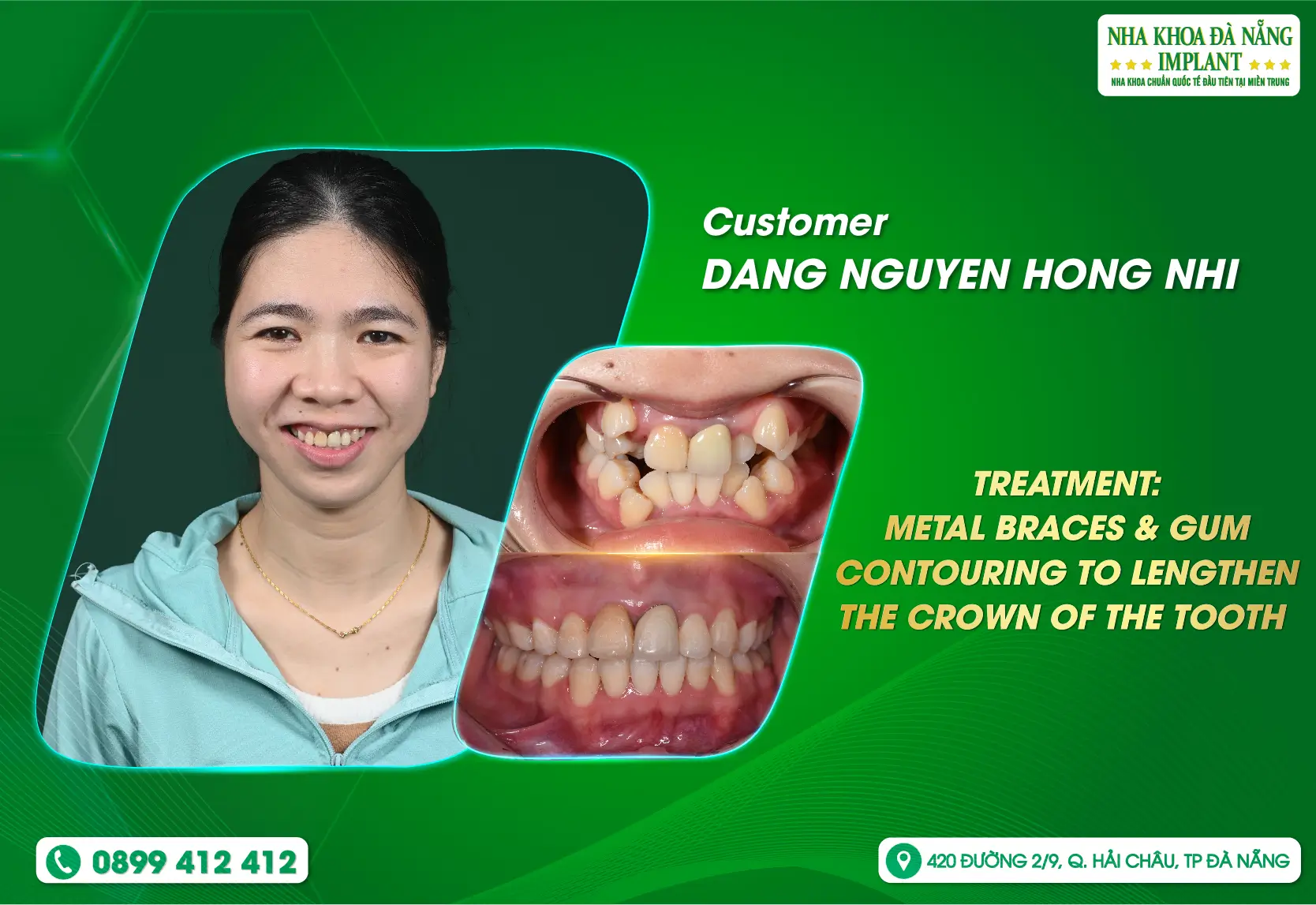[FEEDBACK] Not only for bringing beautiful smiles but also for dedication and professionalism