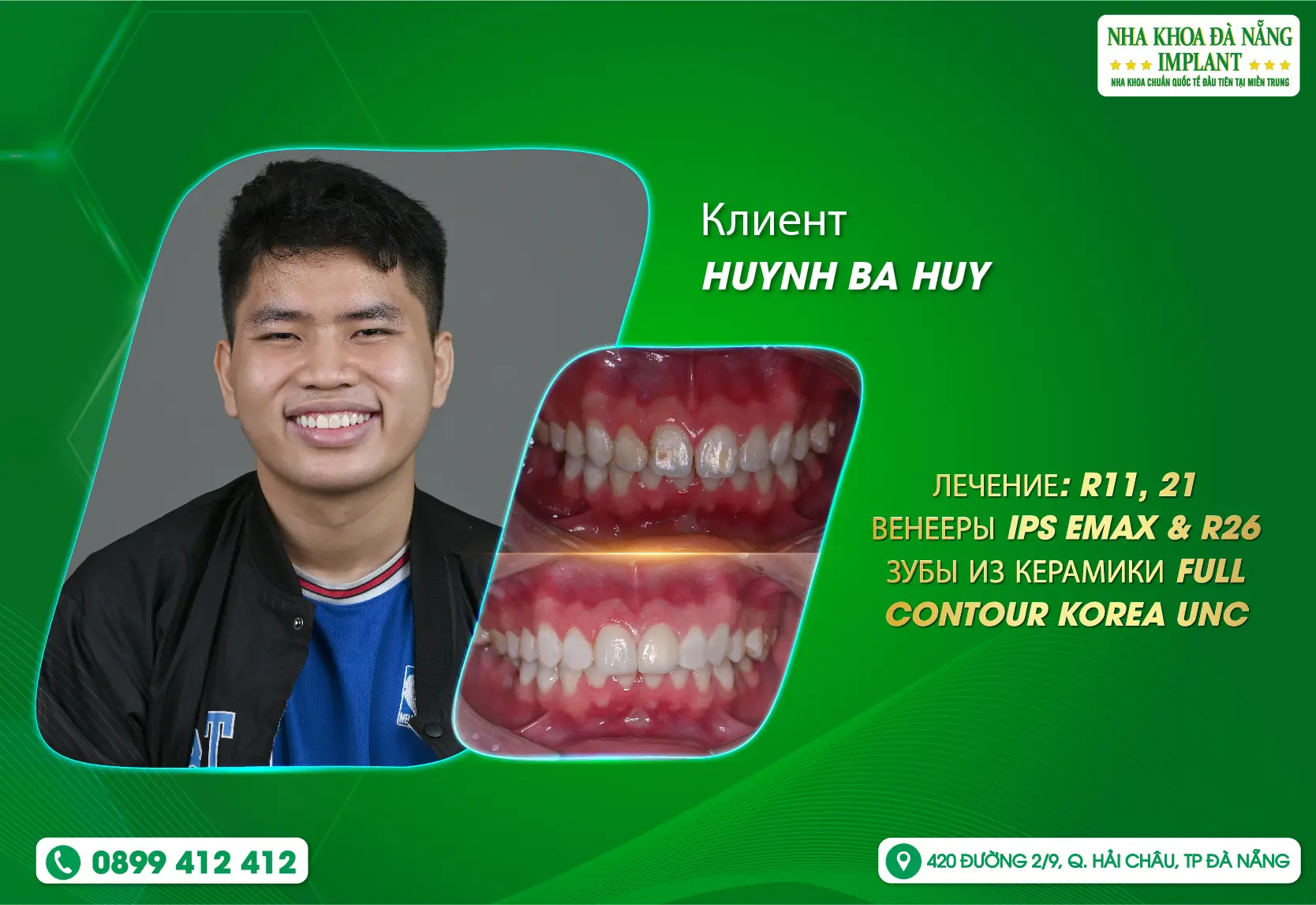 [Отзыв] В клинике Da Nang Implant Dental Clinic врачи очень профессиональны, а сотрудники