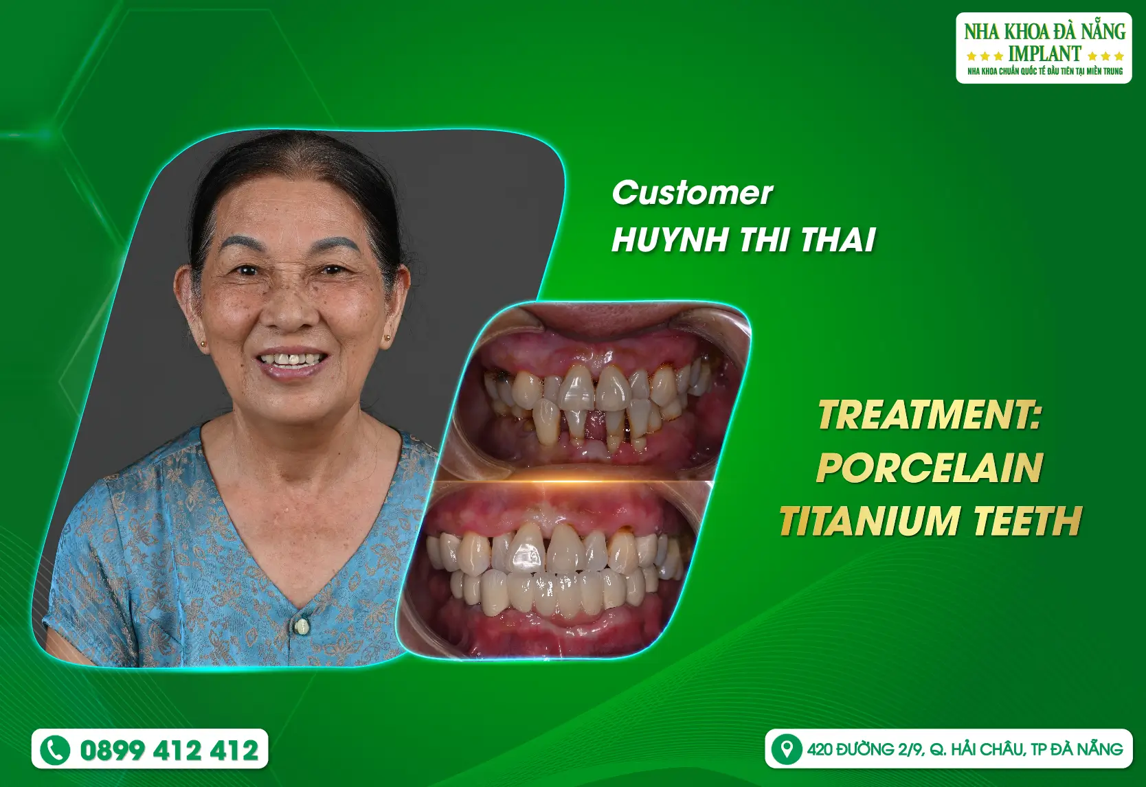 [Feedback] Do not underestimate the dental care of the elderly