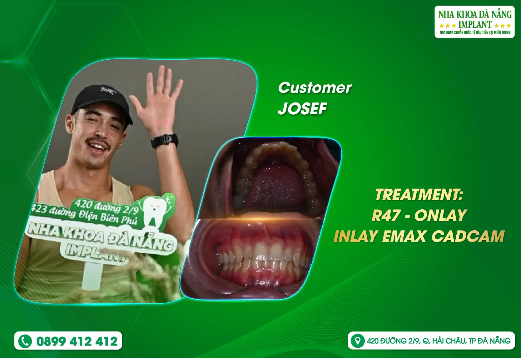[Feedback] DANANG IMPLANT DENTAL CLINIC - A PRESTIGIOUS ADDRESS IN THE HEARTS OF INTERNATIONAL TOURISTS