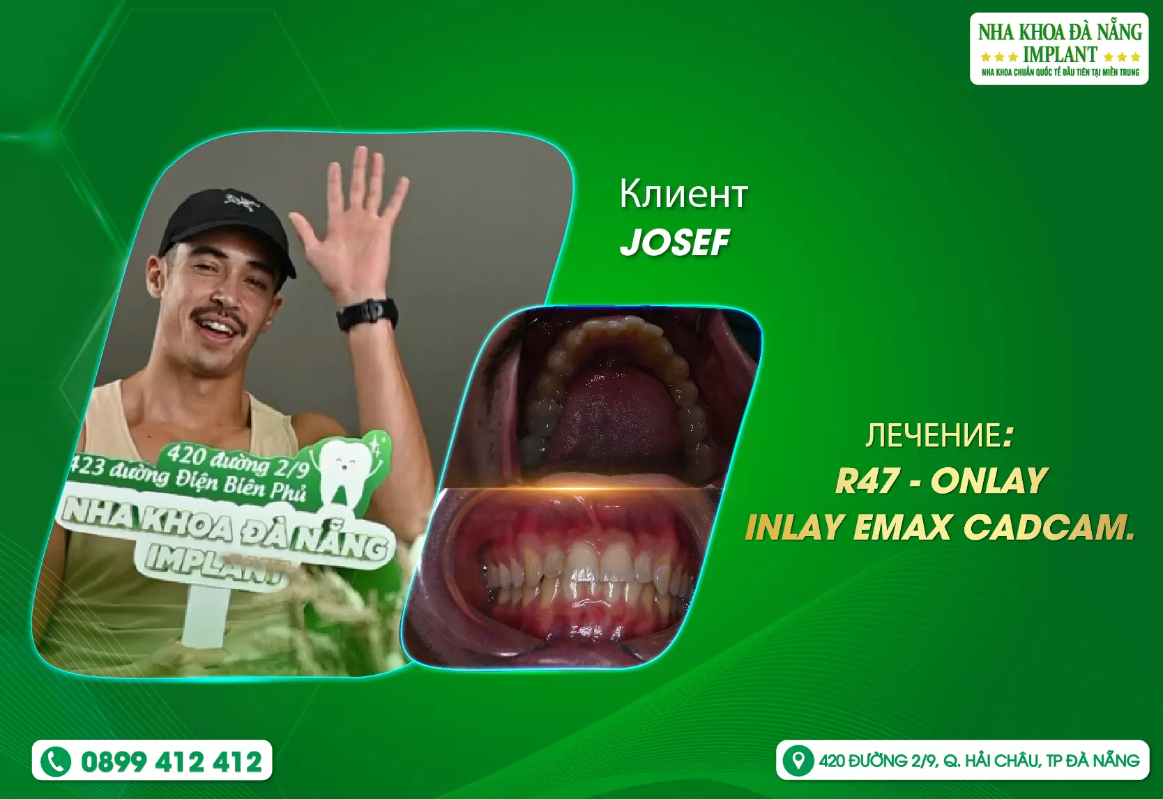 [Отзыв] DA NANG IMPLANT DENTAL CLINIC - НАДЕЖНАЯ КЛИНИКА В ГЛАЗАХ МЕЖДУНАРОДНЫХ ТУРИСТОВ