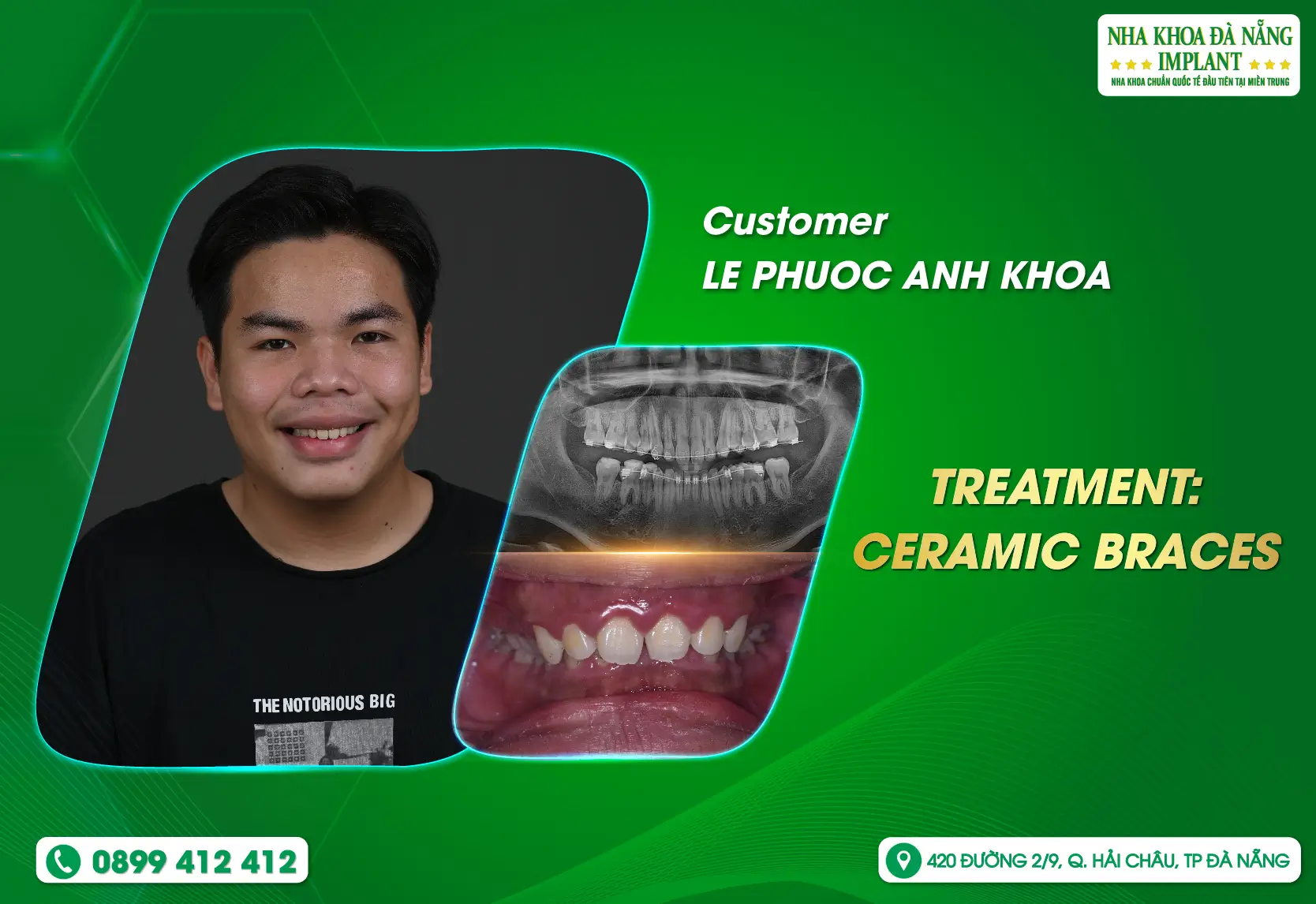 [Feedback] We always accompany customers on the journey to find a bright smile.