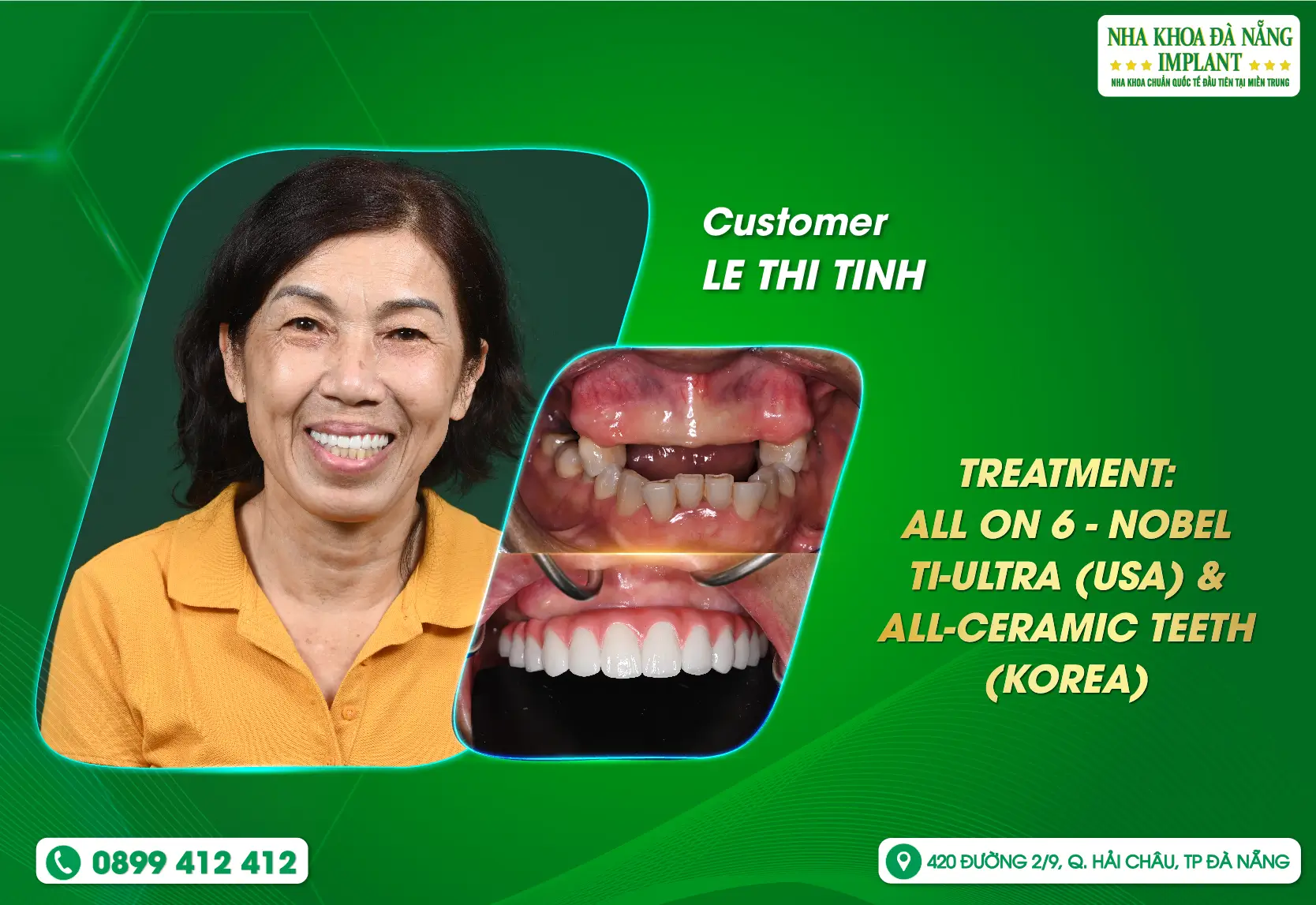 [FEEDBACK] Not only treatment but also accompanying customers