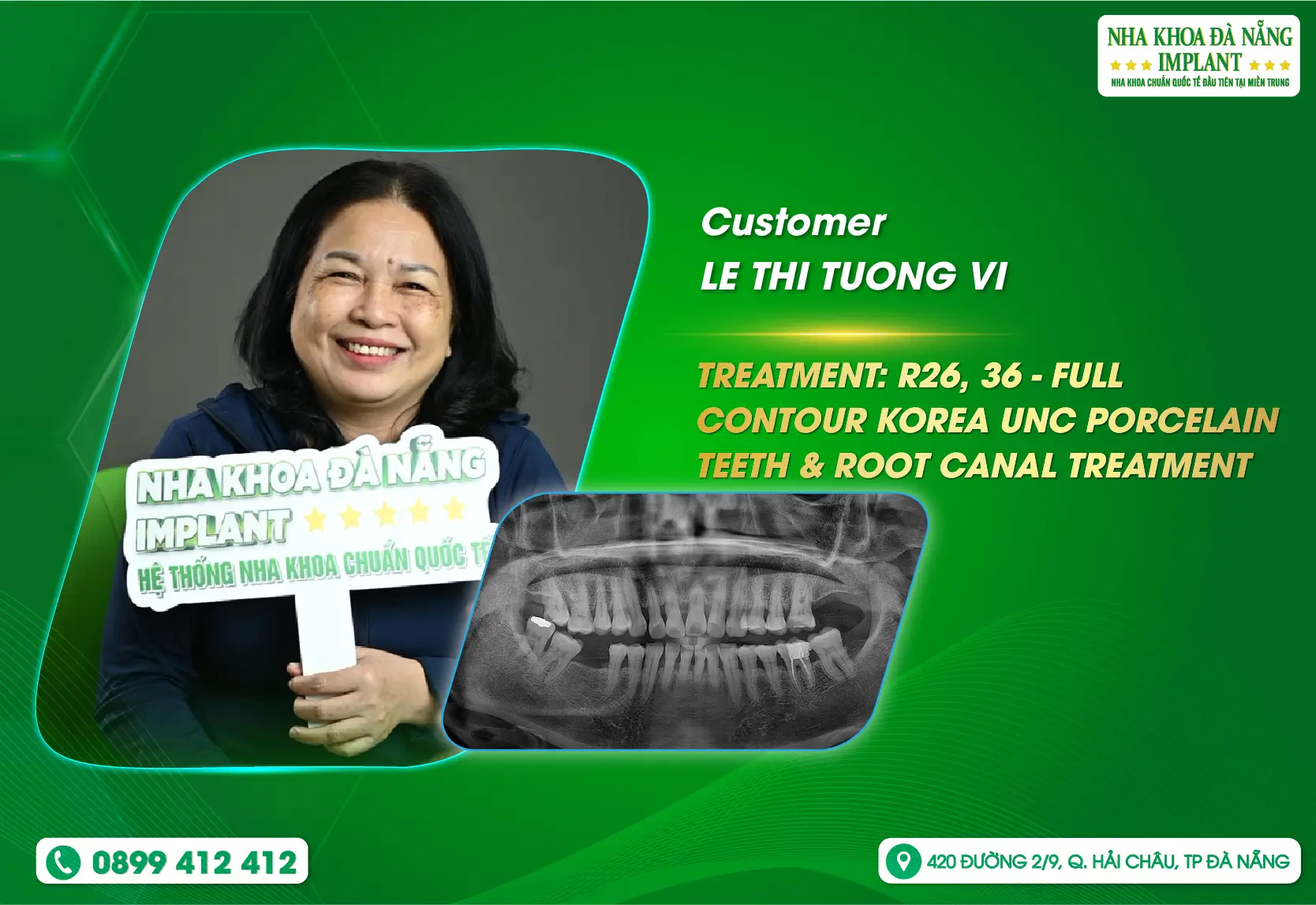 [Feedback] Customer sentiment is the valuable motivation for Da Nang Implant Dental Clinic to always develop