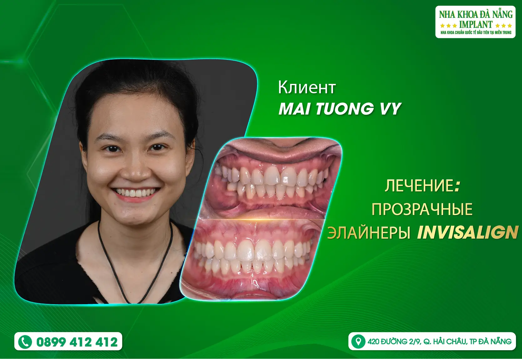 [Обратная связь] Пусть клиенты станут движущей силой для развития Da Nang Implant Dental Clinic