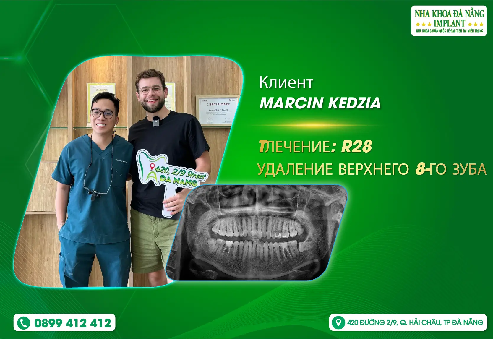 [Отзывы] Danang Dental Implant поможет вам «СКАЖИ ПОКА» навязчивой идее под названием ЗУБЫ МУДРОСТИ