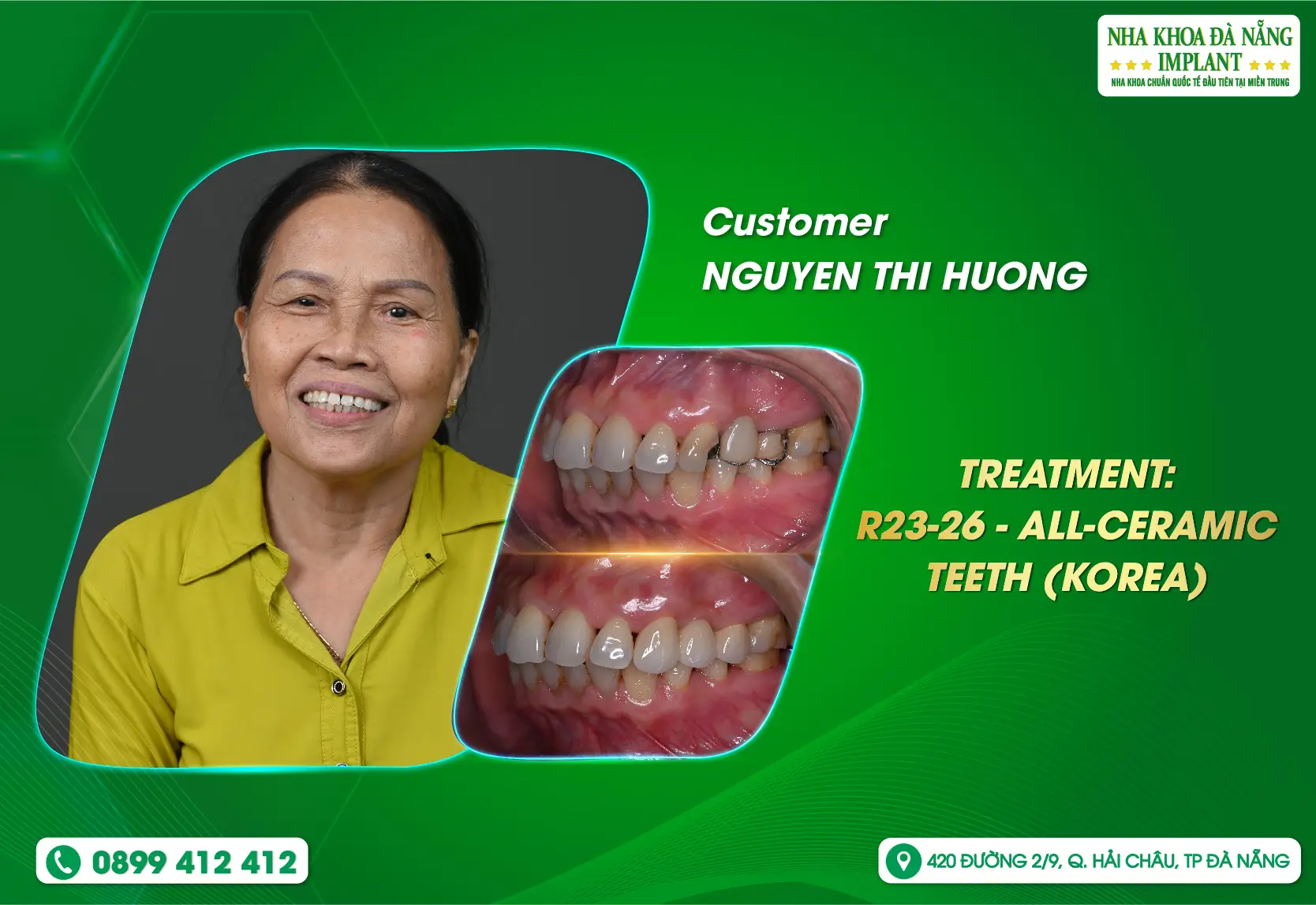 [Feedback] There is nothing better than having healthy teeth and being confident