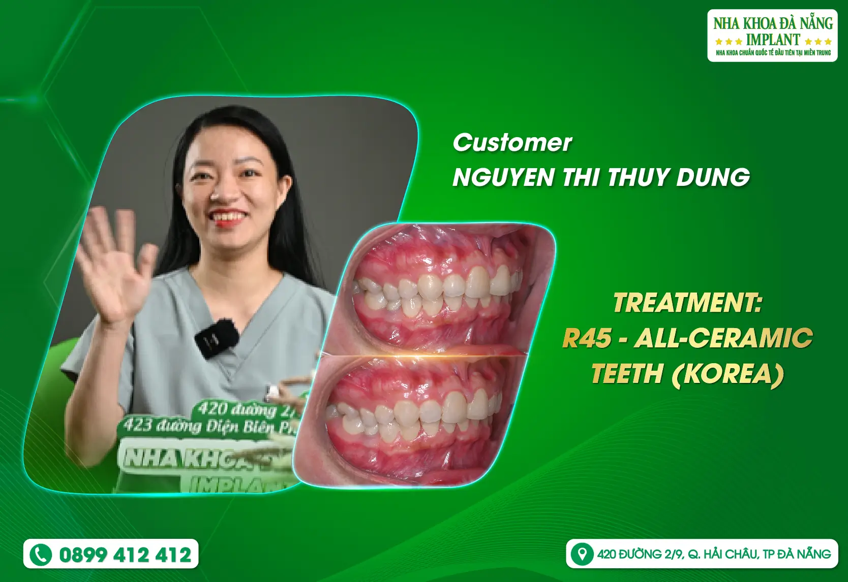 [Feedback] Customer comfort is the top priority of Danang Implant Dental Clinic