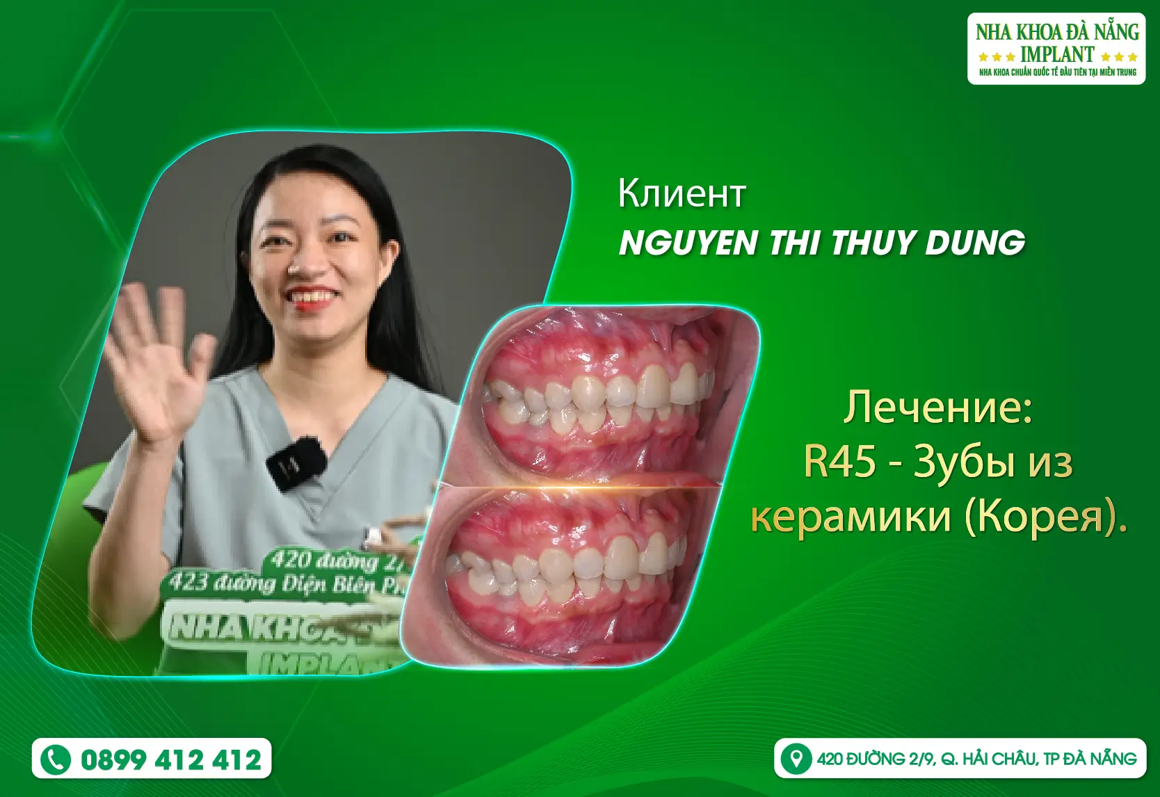 [Отзыв] Комфорт клиента — главный приоритет в Da Nang Implant Dental Clinic
