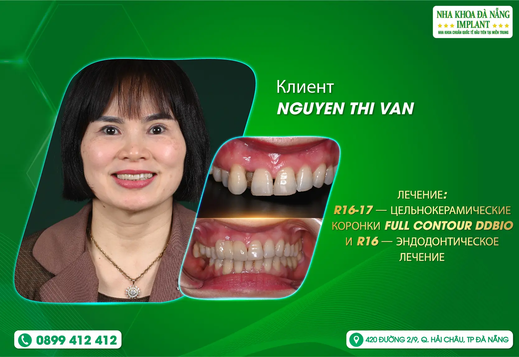 [Обратная связь] Любовь к профессии у врачей Da Nang Implant Dental Clinic