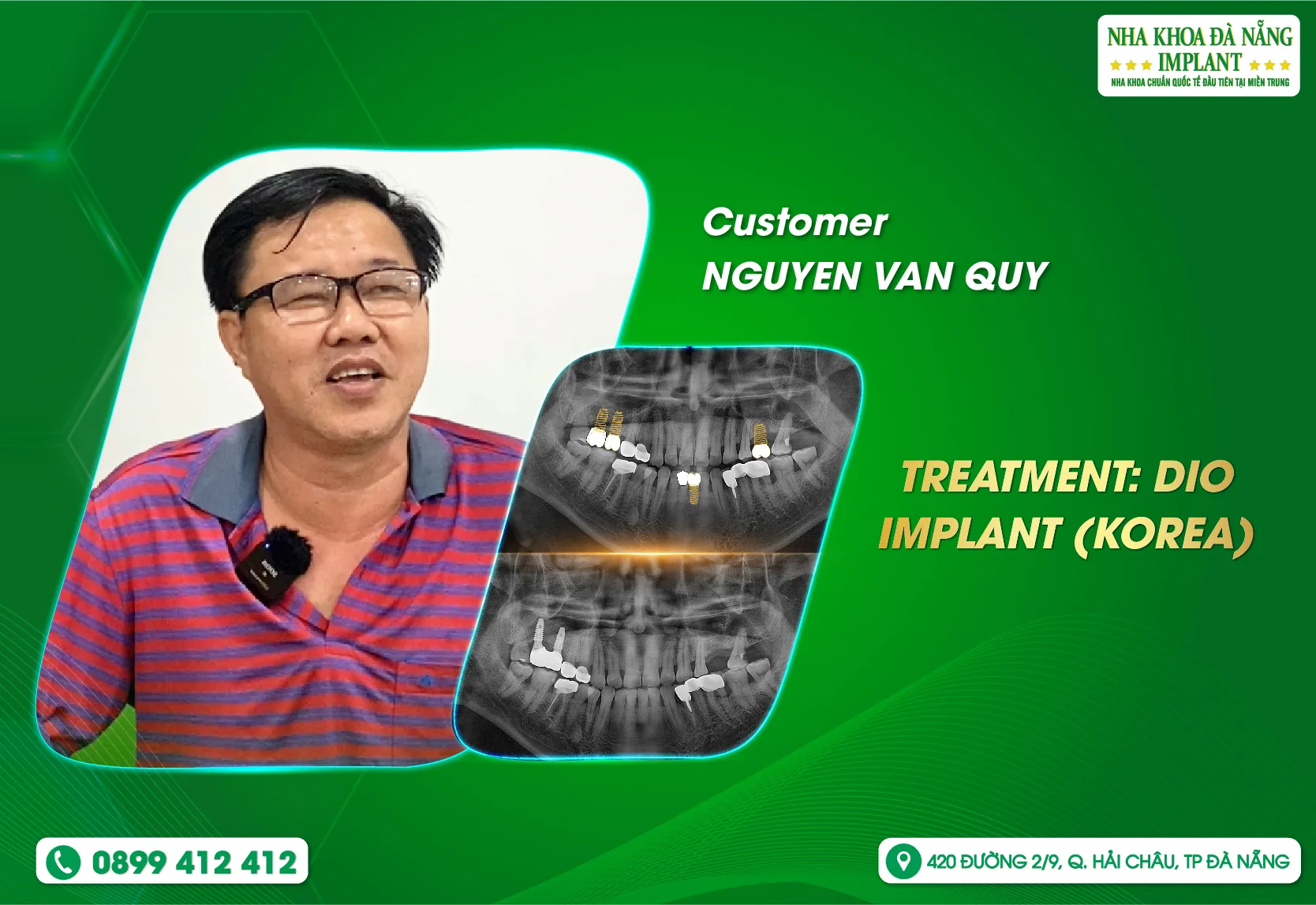 Implants are painless, you can chew and chew with confidence