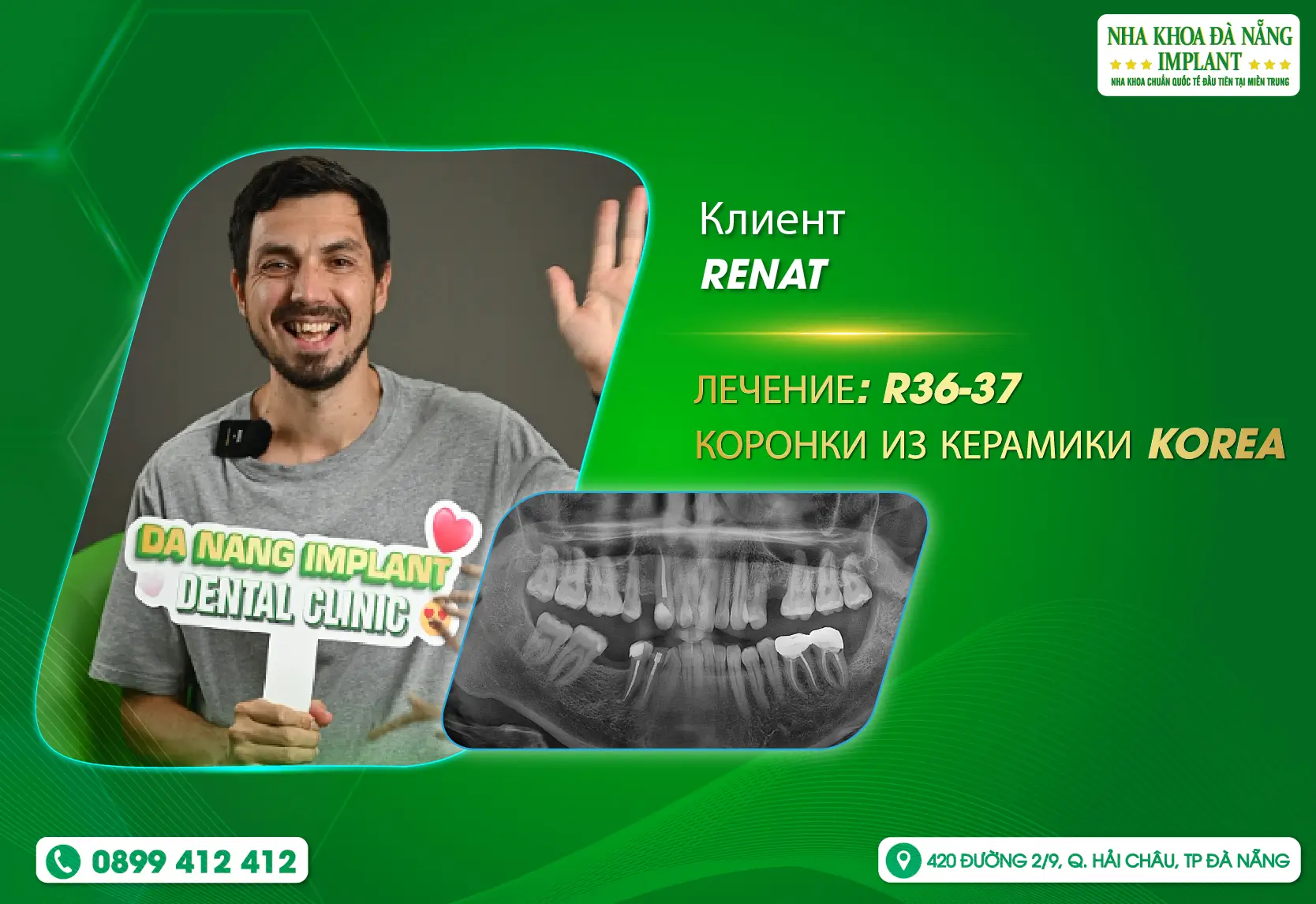 [Отзыв] Da Nang Implant Dental Clinic действительно ли 