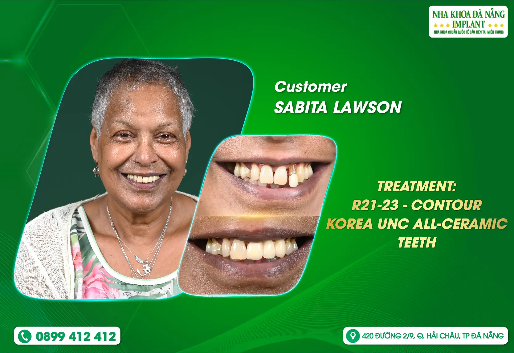 [FEEDBACK] Customer trust - Great motivation of Danang Implant Dental Clinic