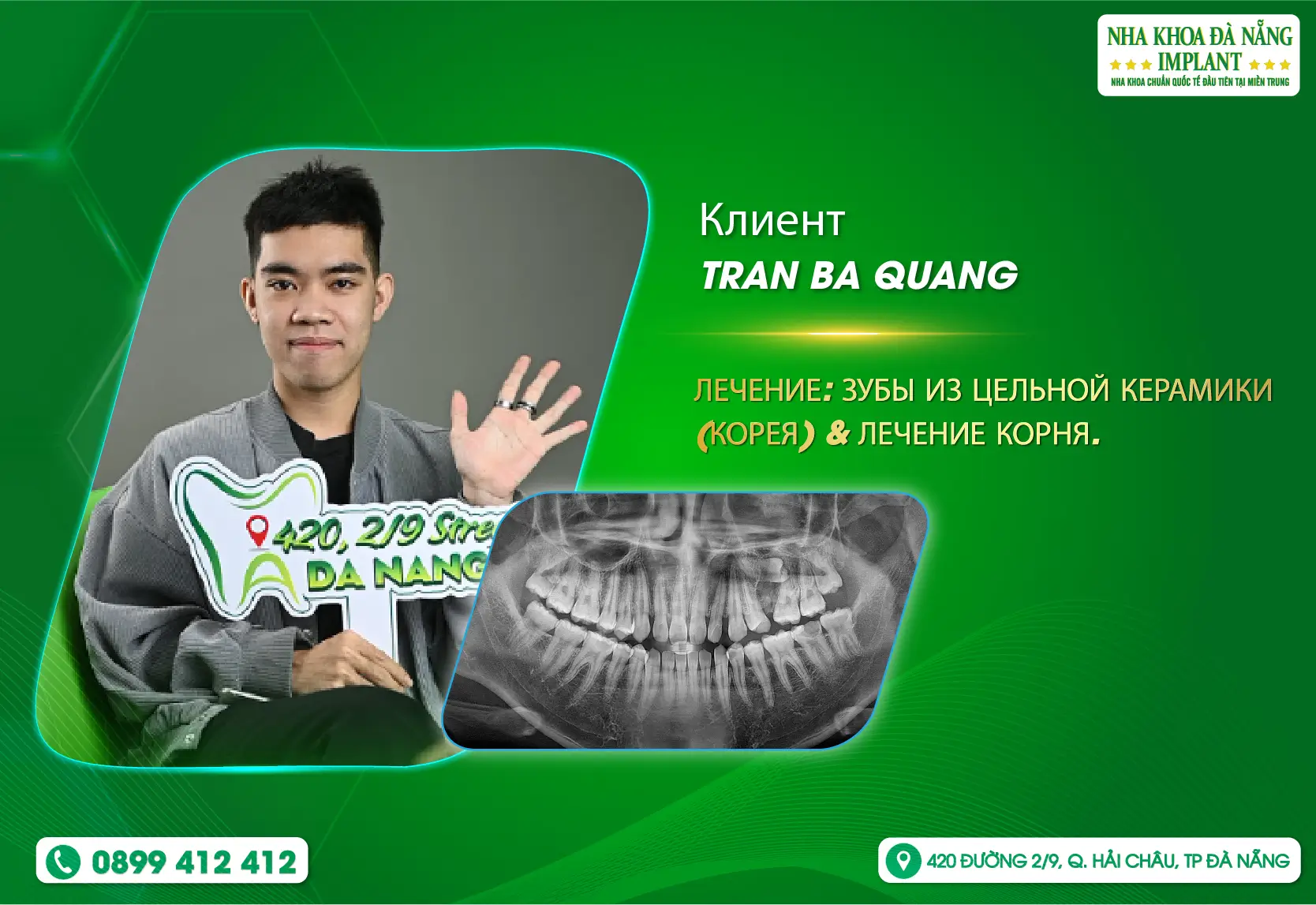 [Отзыв] Приносить уверенную улыбку своим клиентам — это счастье для Da Nang Implant Dental Clinic