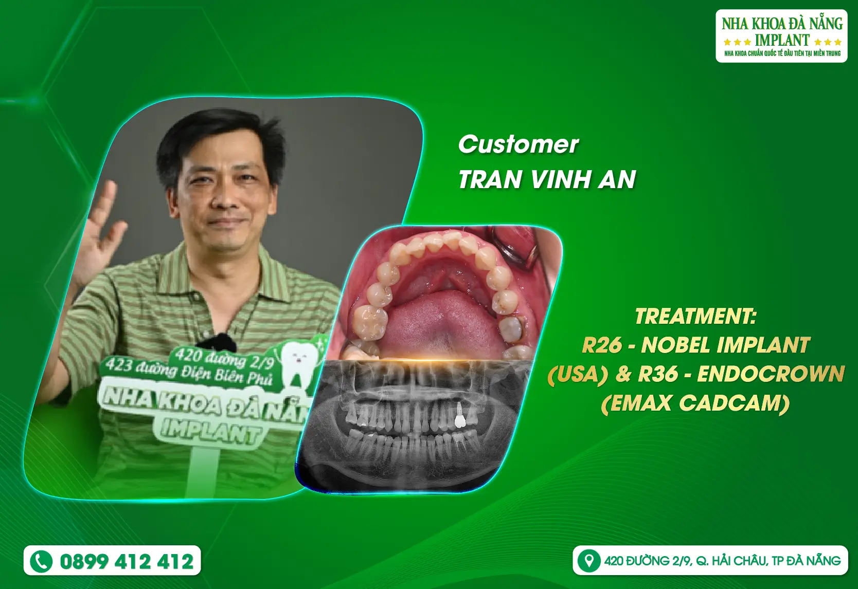 [Feedback] Every time I think about dental work, it feels like a nightmare. But at Da Nang Implant Dental Clinic, I feel very secure.