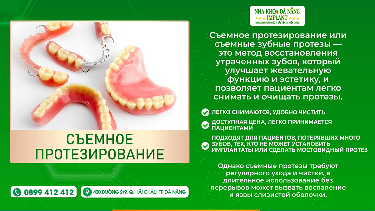 Частичное съемное протезирование