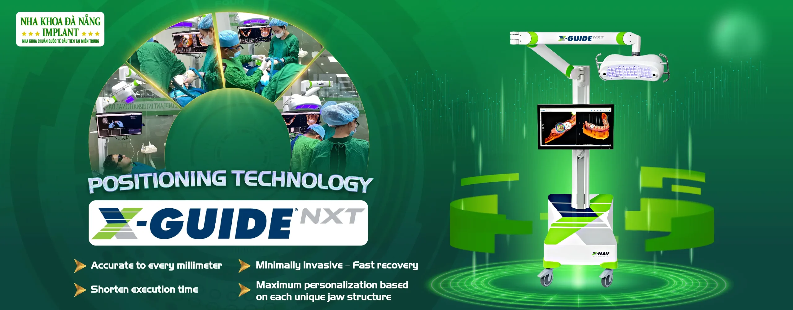 X-Guide Technology Officially Introduced in Central Vietnam – Exclusively at Da Nang Implant Dental Clinic