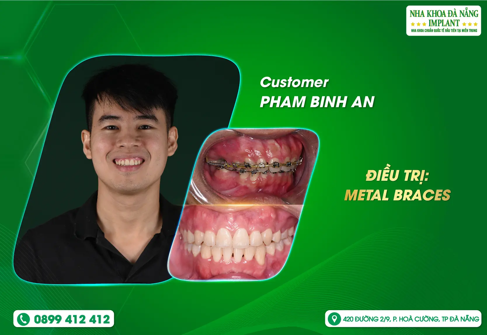 Behind a beautiful smile is a journey of persistent effort.