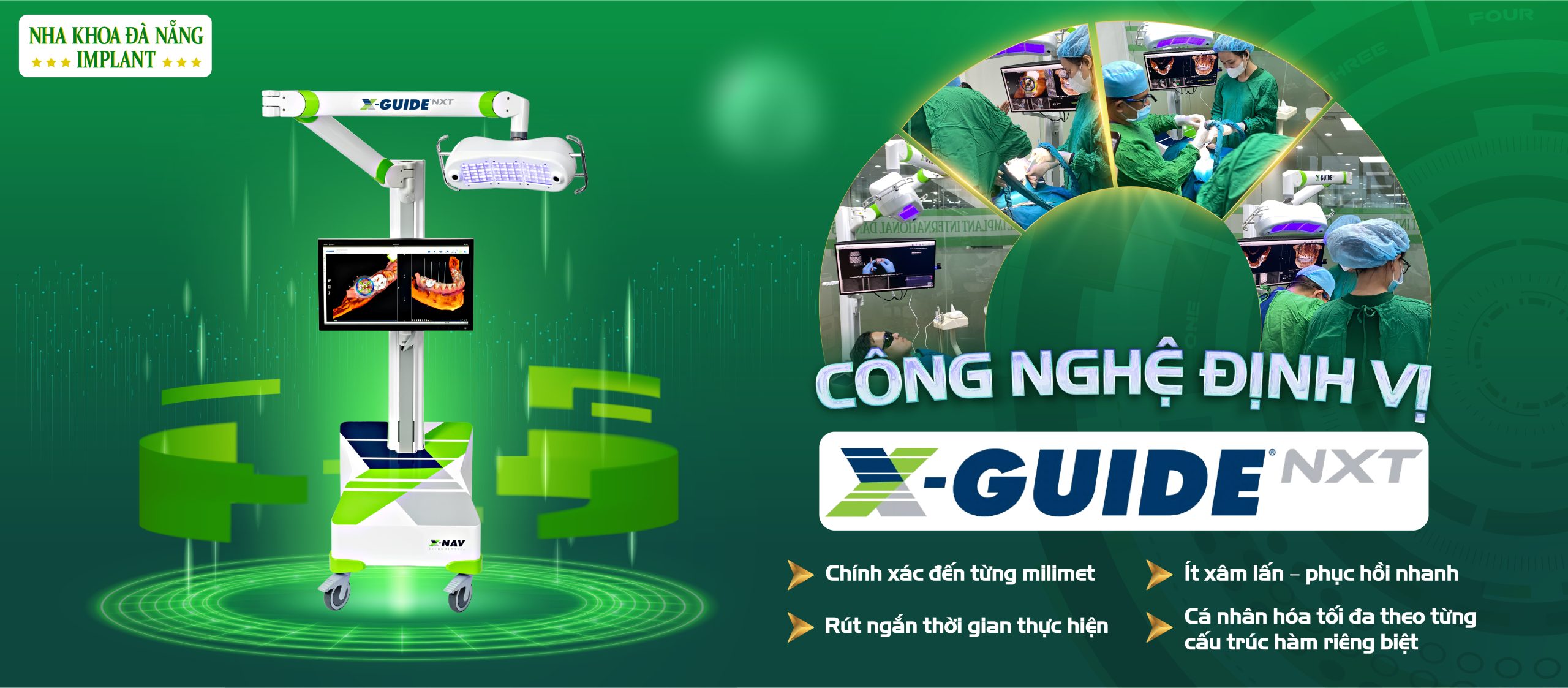 Cấy ghép Implant bằng công nghệ X-Guide chính thức có mặt đầu tiên tại miền Trung